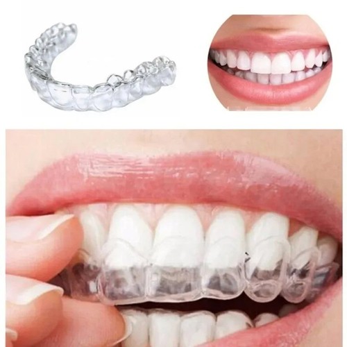 Teeth whitening mouth - teeth,