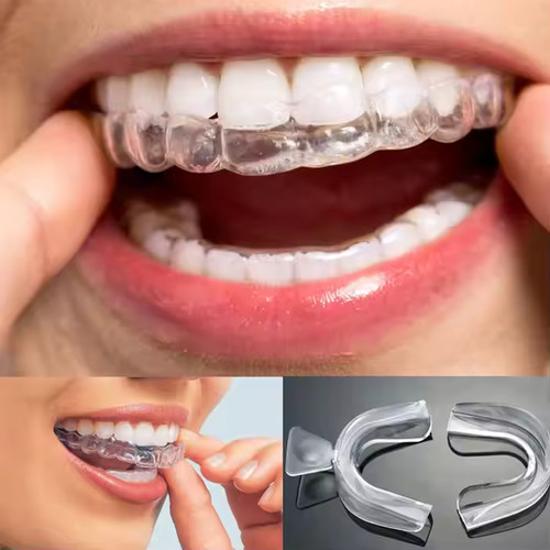 Teeth whitening mouth trays - whitening,