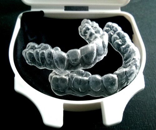 Teeth whitening bleaching - whitening,