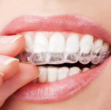 Teeth Whitening Trays 4 Pack