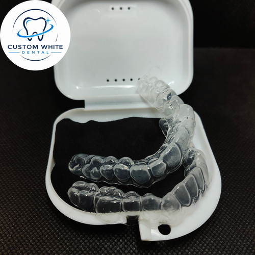 Custom teeth whitening - custom,