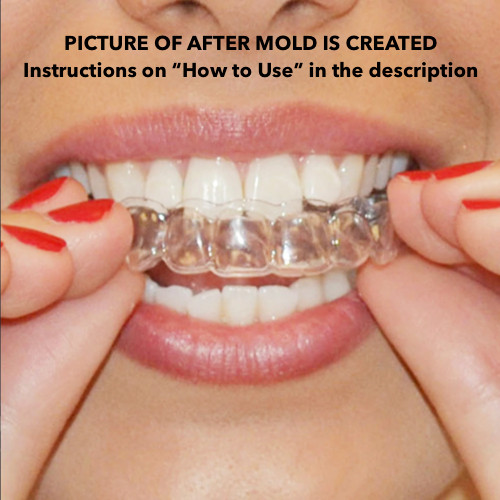 Teeth whitening mouth - whitening,