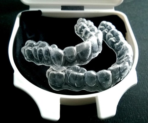 Teeth whitening bleaching - /,